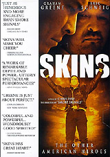 Skins Формат: DVD (NTSC) (Keep case) Дистрибьютор: First Look Home Entertainment Региональный код: 1 Субтитры: Испанский Звуковые дорожки: Английский Dolby Digital 2 0 Формат изображения: инфо 3057b.